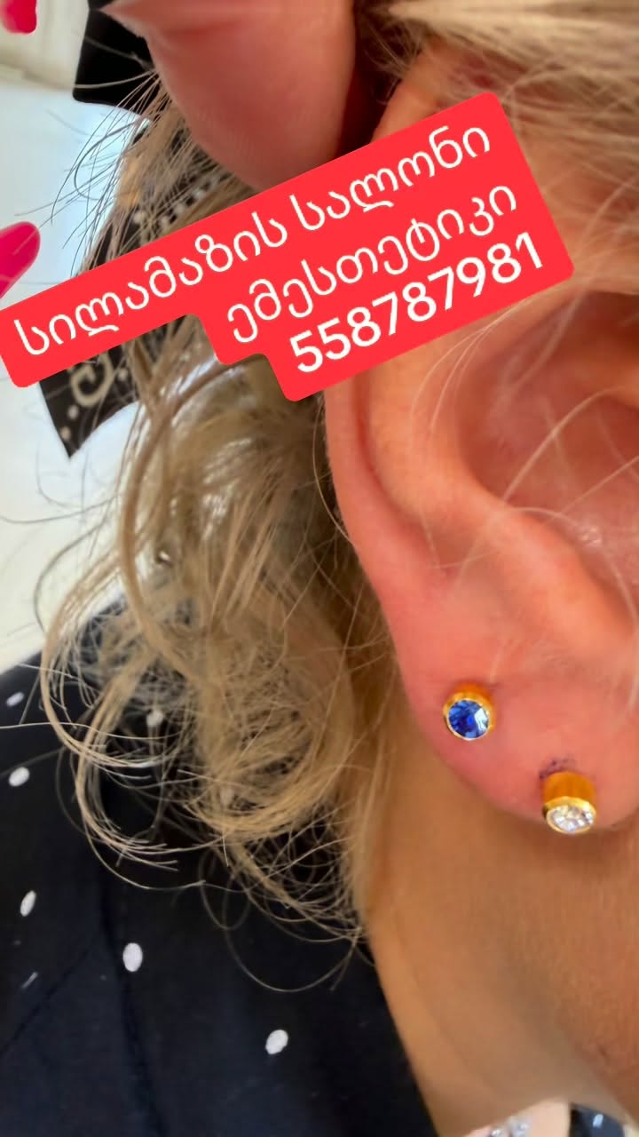 Gözlərin gözəlliyi salonu əməliyyat❤️‍🔥 ☎️